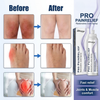 Pro PainRelief Restorative Joint Spray | Restores Joint Comfort and Mobility in 93% of Cases in Just 4 Days